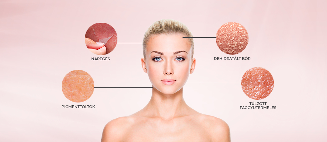 Nyári bőrápolás: Problémák és megoldások